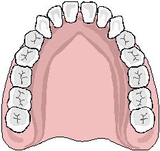 The maxillary arch has tooth numbers 1 to 16 and each tooth has different sides.